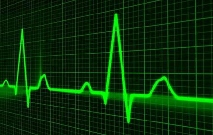 Hjart Puls